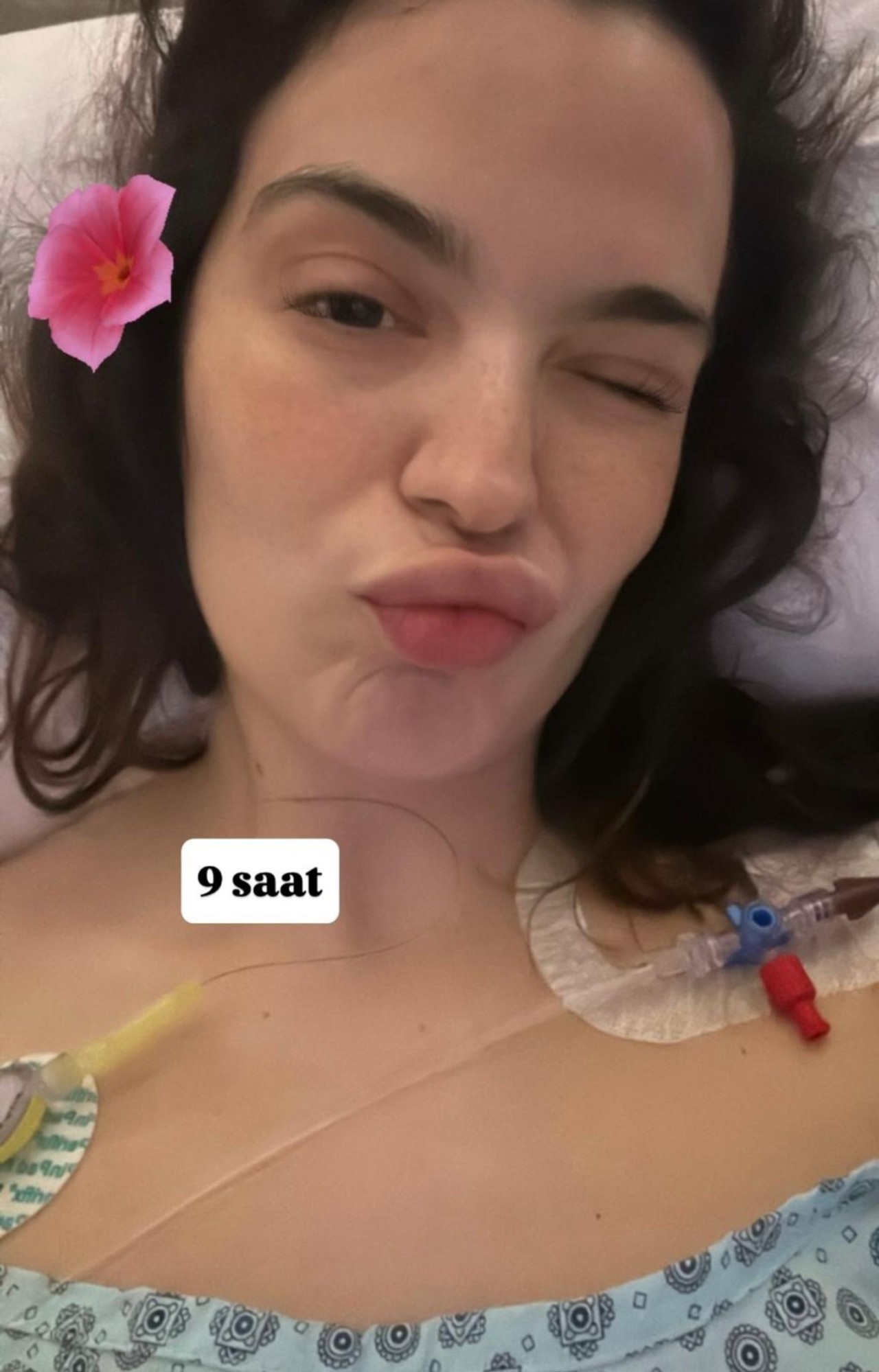 Aktrisa həkimin səhvinə görə 6 dəfə əməliyyat keçirdi